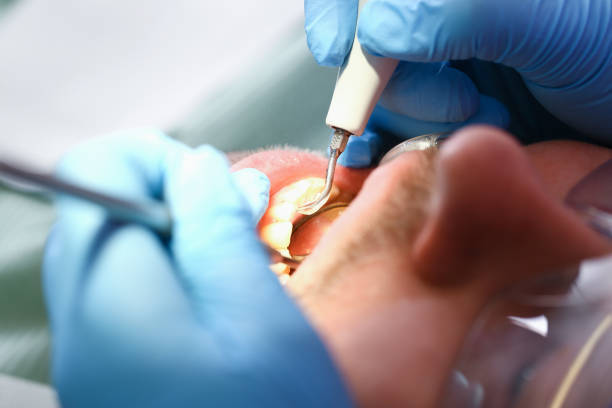 Best Weekend Emergency Dentist in Brodhead, WI