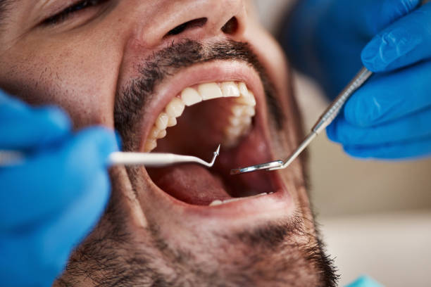 Best Emergency Treatment for Dental Infections or Abscesses in Brodhead, WI